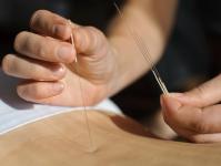 Akupunktúra na chudnutie: pomôže zlatá ihla v uchu znížiť chuť do jedla